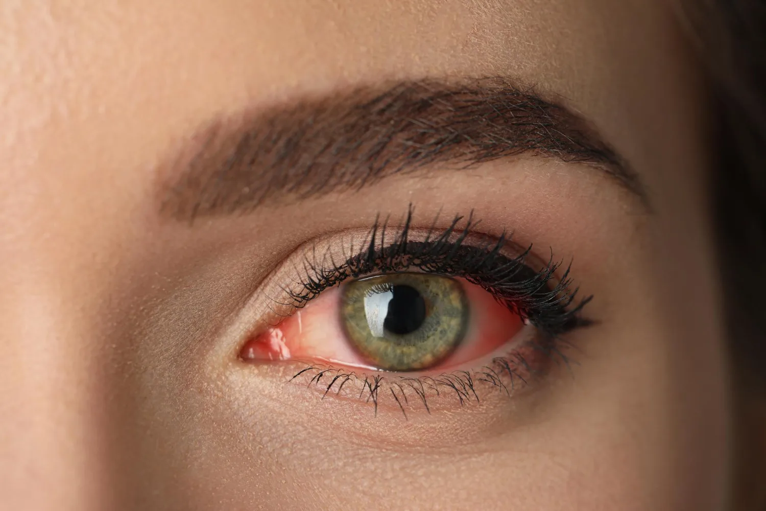 Clínica de ojo seco en Estado De México e Hidalgo: Atención Especializada para tu Salud Visual